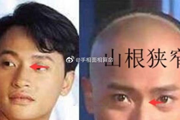 面相解读：断眉命相的深层寓意与人生影响