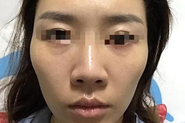 面相分析：颧骨突出的命运影响与解读