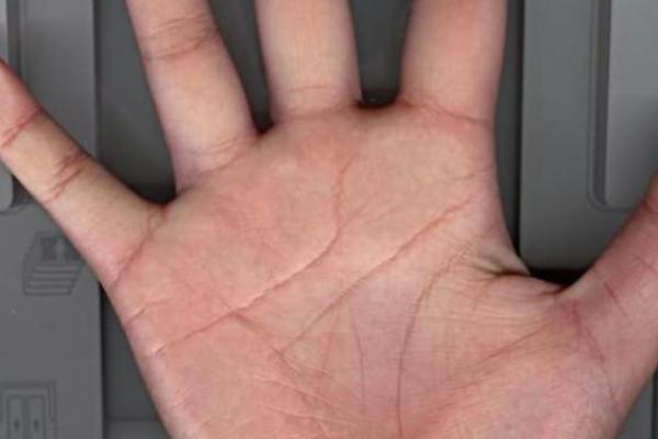 男童手掌纹路粗糙，揭示他背后的命运与性格潜能