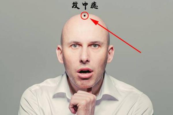 男人为什么有两颗痣命好？揭开神秘面纱的真相！