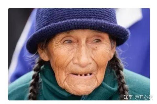缺牙女孩的命运：微笑背后的故事与希望