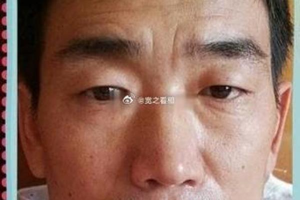 面相印堂横纹解析：揭示命运中的秘密与智慧