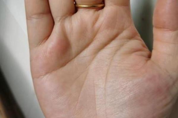 女人胳膊粗的命运解析：从身体特征看性格与人生轨迹