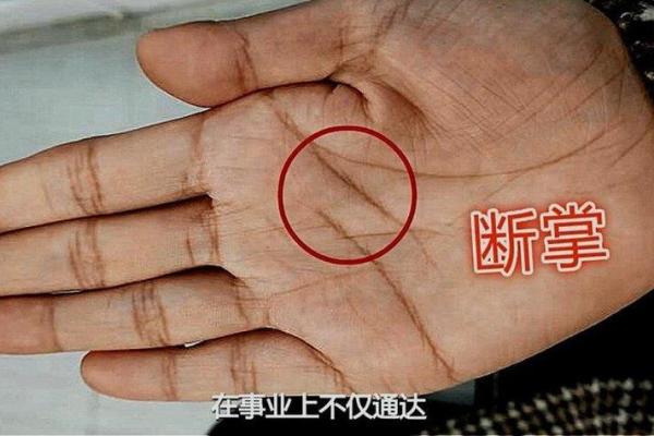 两手手纹分析：刀纹命运与人生的深刻联系