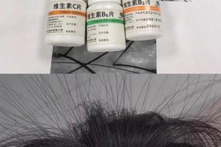 女人头发秃背后的秘密：命运与自信的双重考验