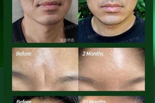 女人眉毛有川字纹的命运解析与人生观照