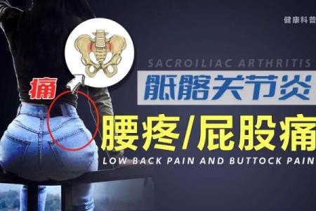 屁股打一下痛如命,究竟是什么病?