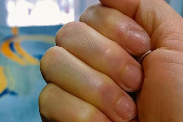 男生十指无斗，命自其手，人生路上的奋进与挑战
