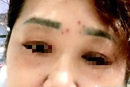 女人腿上长毛的命运解读:从生理到命理的探索