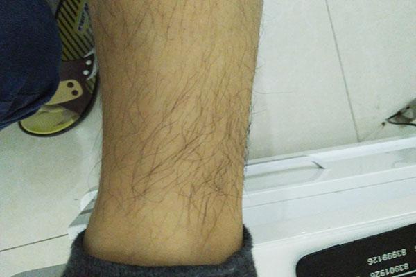 没有腿毛的男生，究竟是什么命运？
