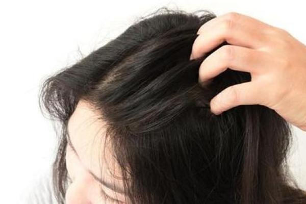 女性秃头的背后：揭示命运与内在的深层次联系