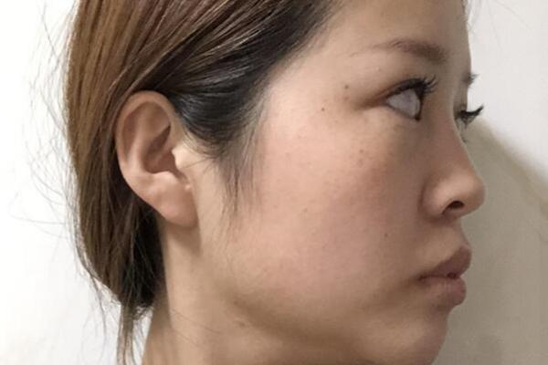 女人下巴初出来的命运与未来展望