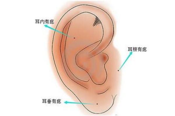 男下颚有痣，命运如何？深入解析痣相对人生的影响！