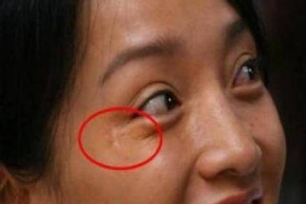 女人左眼大右眼小的命运解析：神秘面相揭示的性格与运势