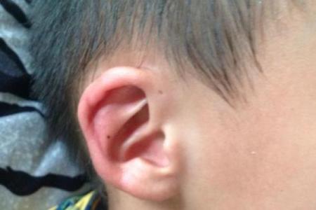 女孩耳垂与命运：揭示两个耳仓背后的秘密与启示