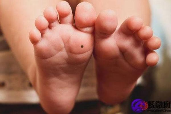 女人左脚有痣是什么命？解密生命特征与命运的奇妙联系