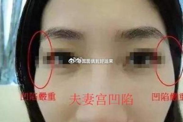 梨涡的命理学解读：揭示脸颊凹陷背后的神秘寓意与性格特征