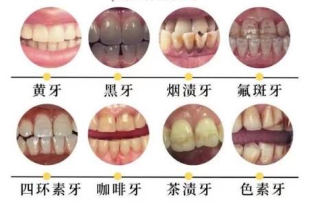 女人22颗牙是什么命？揭示牙齿与命运的神秘关系！