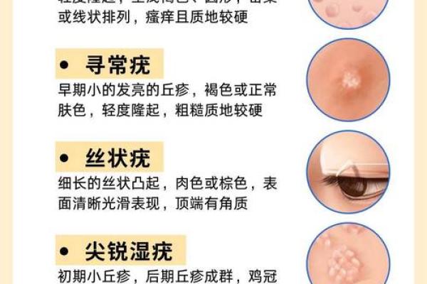 脸上长疣的女人运势解析：宿命与转机的交织