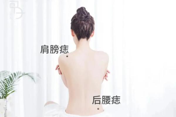 探秘：男人右背腰长痣为何被认为命好？