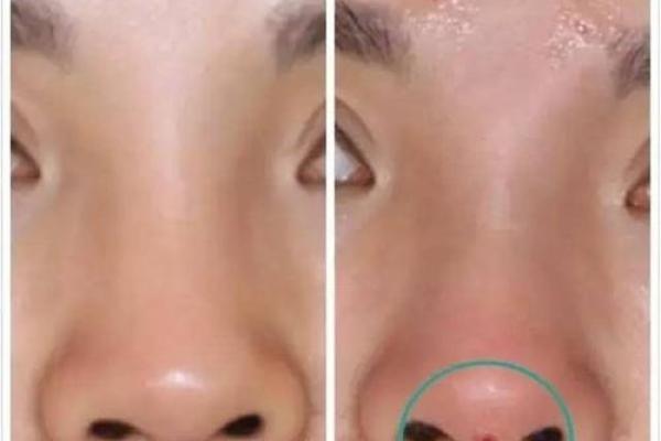 女孩子鼻翼宽大象征命运与性格的奥秘探究