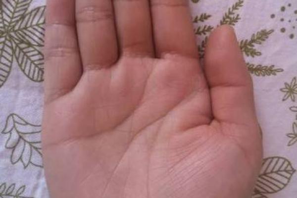 探秘女人手掌黑点之谜：命运的独特象征与解读