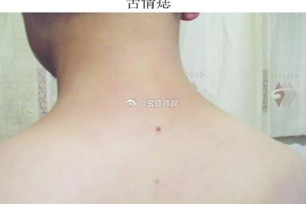 女人身上长红痣的命理解析：它预示着怎样的情感与财富？