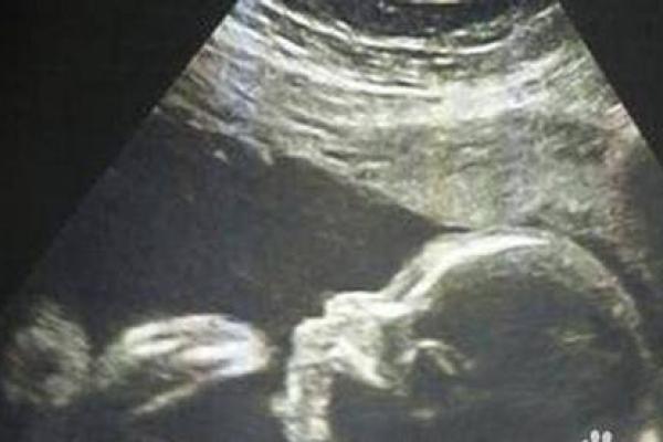 揭秘女性生男孩的命局：有哪些因素影响胎儿性别？