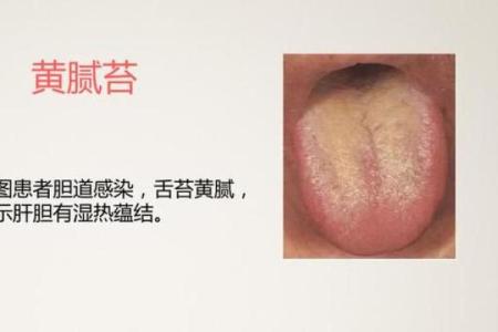 命里有积滞的含义与化解方法探讨